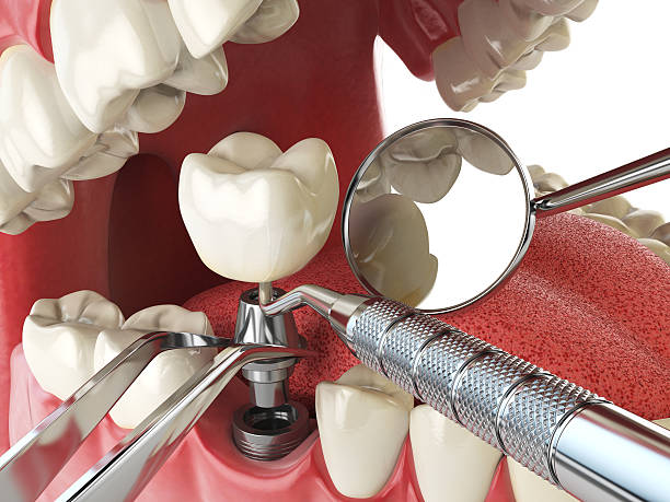Best Emergency Denture Repair in Rosend, LA