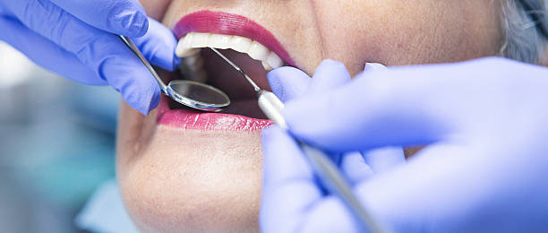 Best Emergency Treatment for Dental Infections or Abscesses in Rosend, LA